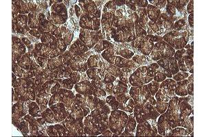 Image no. 3 for anti-Mitogen-Activated Protein Kinase Kinase 1 (MAP2K1) antibody (ABIN1499375)