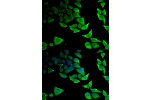 Immunofluorescence analysis of MCF-7 cells using SNCA antibody. (SNCA anticorps  (AA 61-140))