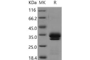 Kallikrein 7 (KLK7) (Active) protein (His tag)