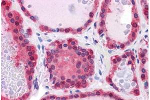 Human Thyroid: Formalin-Fixed, Paraffin-Embedded (FFPE)