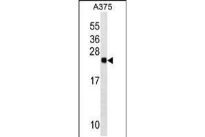 Western blot analysis in A375 cell line lysates (35ug/lane). (RAB2B anticorps  (AA 105-131))