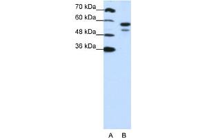 WB Suggested Anti-U2AF2 Antibody Titration:  1. (U2AF2 anticorps  (N-Term))