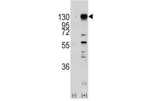 Western blot analysis of FGF receptor antibody and 293 cell lysate (2 ug/lane) either nontransfected (Lane 1) or transiently transfected with the FGFR1 gene (2).