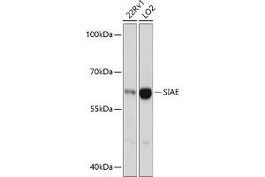 Western blot analysis of extracts of various cell lines, using SIAE antibody (ABIN6132918, ABIN6147755, ABIN6147756 and ABIN6217135) at 1:3000 dilution.