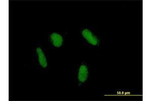 Immunofluorescence of purified MaxPab antibody to ZNF436 on HepG2 cell. (ZNF436 anticorps  (AA 1-470))