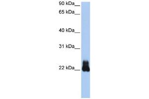 WB Suggested Anti-RHOD Antibody Titration:  0. (RHOD anticorps  (N-Term))