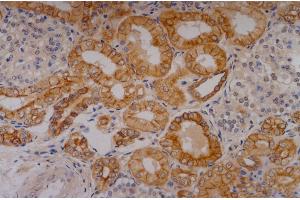 Immunohistochemistry staining of human kidney (paraffin-embedded sections) with anti-Cytokeratin 18 (C-04).
