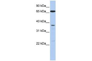 WB Suggested Anti-ABCB9 Antibody Titration:  0. (ABCB9 anticorps  (N-Term))