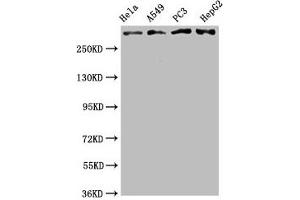 Western Blot Positive WB detected in: Hela whole cell lysate, A549 whole cell lysate, PC3 whole cell lysate, HepG2 whole cell lysate All lanes: ATM antibody at 2. (Recombinant ATM anticorps)