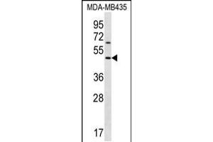 Western blot analysis in MDA-MB435 cell line lysates (35ug/lane). (KERA anticorps  (C-Term))
