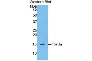 Western Blotting (WB) image for anti-Solute Carrier Family 30 (Zinc Transporter), Member 8 (SLC30A8) (AA 263-369) antibody (ABIN1176292)