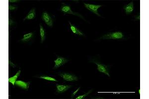 Immunofluorescence of purified MaxPab antibody to CSDA on HeLa cell.