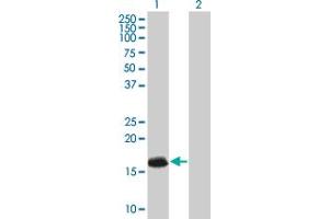 Lane 1: ATRX transfected lysate ( 9. (ATRX 293T Cell Transient Overexpression Lysate(Denatured))