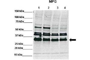 WB Suggested Anti-MPG Antibody    Positive Control:  Lane1: 50ug RCC4 lysate, Lane2: 50ug RCC4 lysate, Lane3: 50ug 786-0 lysate, Lane4: 50ug 786-0 lysate  Primary Antibody Dilution :   1:1000  Secondary Antibody :   Anti-rabbit-Alexa 680   Secondry Antibody Dilution :   1:5000  Submitted by:  Dr Ester Hammond, Gray Institute for Radiation Oncology and Biology-Department of Oncology, University of Oxford