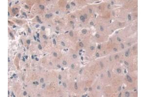 DAB staining on IHC-P; Samples: Human Liver Tissue (USP6NL anticorps  (AA 1-292))