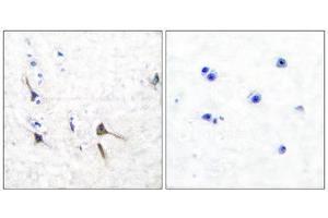 Immunohistochemistry (IHC) image for anti-Kv3.2b Potassium Channel (C-Term) antibody (ABIN1848746) (Kv3.2b Potassium Channel anticorps  (C-Term))
