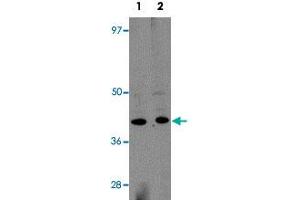 Western blot analysis of rat brain tissue with KCNK18 polyclonal antibody  at (Lane 1) 1 and (Lane 2) 2 ug/mL dilution. (KCNK18 anticorps)