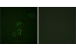 Immunofluorescence analysis of HepG2 cells, using CD171/N-CAML1 (Ab-1181) Antibody.
