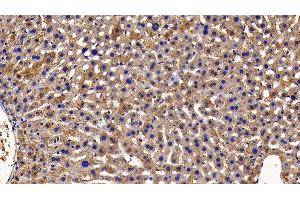 Detection of NFKB3 in Mouse Liver Tissue using Polyclonal Antibody to Transcription Factor P65 (NFKB3)
