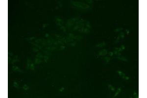 Detection of TJP2 in Human Hela Cells using Polyclonal Antibody to Tight Junction Protein 2 (TJP2)