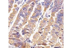 IHC analysis of FFPE mouse stomach section using Ror2 antibody; Ab was diluted at 1:25. (ROR2 anticorps  (AA 750-800))