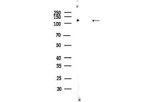 anti-Class II, Major Histocompatibility Complex, Transactivator (CIITA) (Internal Region) antibody