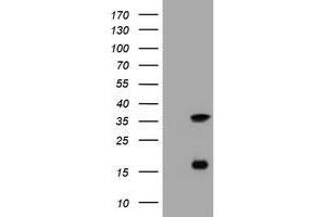Image no. 5 for anti-Thymidylate Synthetase (TYMS) antibody (ABIN1501589) (TYMS anticorps)