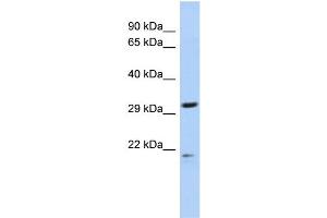 WB Suggested Anti-C14orf80 Antibody Titration: 0. (C14ORF80 anticorps  (N-Term))