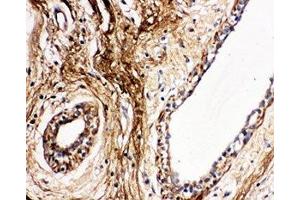 IHC-P: Protein C antibody testing of human breast cancer tissue
