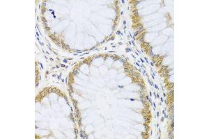 Immunohistochemistry of paraffin-embedded human colon using ARL6 antibody at dilution of 1:100 (x40 lens).
