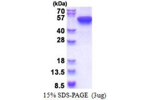 SDS-PAGE (SDS) image for Keratin 16 (KRT16) (AA 1-473) protein (His tag) (ABIN5853597)
