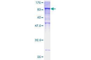 Image no. 1 for Dynein, Axonemal, Intermediate Chain 2 (DNAI2) (AA 1-593) protein (GST tag) (ABIN1351748)