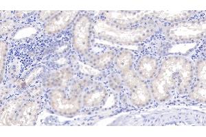 Detection of C1qB in Human Kidney Tissue using Polyclonal Antibody to Complement Component 1, Q Subcomponent B (C1qB) (C1QB anticorps  (AA 28-253))