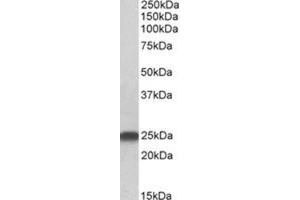 AP31418PU-N LIN7B antibody staining of Rat Brain lysate at 0. (LIN7B anticorps  (N-Term))