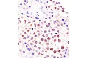 (ABIN652911 and ABIN2842587) staining ELAVL1 in human testis tissue sections by Immunohistochemistry (IHC-P - paraformaldehyde-fixed, paraffin-embedded sections).