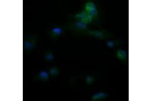 Image no. 2 for anti-Amyloid P Component, Serum (APCS) antibody (ABIN1500900) (APCS anticorps)