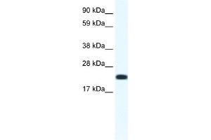 CITED4 antibody (20R-1141) used at 0. (CITED4 anticorps  (N-Term))
