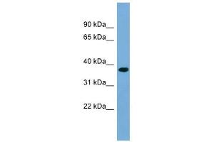 RPRD1B antibody used at 1 ug/ml to detect target protein. (RPRD1B anticorps  (Middle Region))