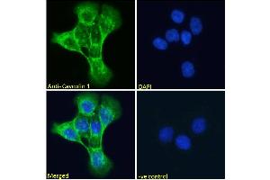 ABIN185421 Immunofluorescence analysis of paraformaldehyde fixed A431 cells, permeabilized with 0.