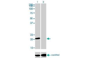Western blot analysis of ATF3 over-expressed 293 cell line, cotransfected with ATF3 Validated Chimera RNAi (Lane 2) or non-transfected control (Lane 1). (ATF3 anticorps  (AA 1-181))