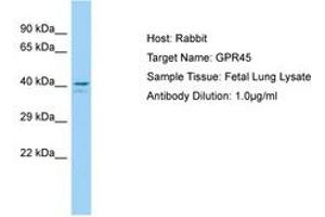 Image no. 1 for anti-G Protein-Coupled Receptor 45 (GPR45) (N-Term) antibody (ABIN6750186)