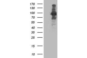 Western Blotting (WB) image for anti-Anaphase Promoting Complex Subunit 2 (ANAPC2) antibody (ABIN1496636) (ANAPC2 anticorps)