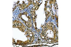 IHC analysis of PSMB4 using anti-PSMB4 antibody (ABIN7600532).
