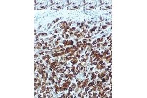 Immunohistochemistry (IHC) image for anti-Secretoglobin, Family 2A, Member 2 (SCGB2A2) antibody (ABIN452654)