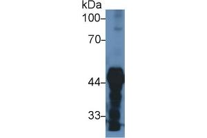 Detection of PDHA1 in Mouse Cerebrum lysate using Polyclonal Antibody to Pyruvate dehydrogenase alpha 1 (PDHA1)