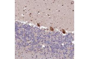 Immunohistochemical staining of human cerebellum with LSG1 polyclonal antibody  shows strong nuclear and cytoplasmic positivity in Purkinje cells at 1:200-1:500 dilution.