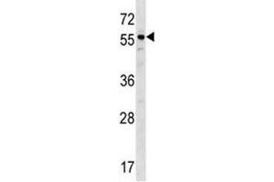 BMP3 antibody western blot analysis in ZR-75-1 lysate. (BMP3 anticorps  (AA 318-347))