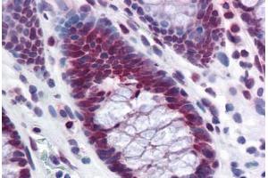 Human Colon: Formalin-Fixed, Paraffin-Embedded (FFPE)