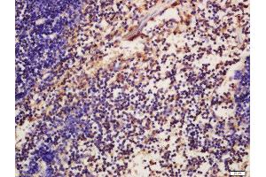 Formalin-fixed and paraffin embedded mouse spleen labeled with Anti-phospho-ATG16A(Ser287)Polyclonal Antibody, Unconjugated  at 1:200 followed by conjugation to the secondary antibody and DAB staining (ATG16L1 anticorps  (pSer287))