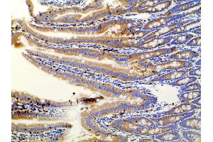 ABIN6267452 at 1/100 staining rat Intestinal tissue sections by IHC-P.